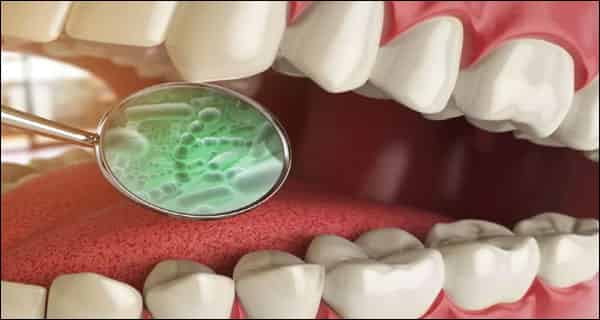 bad breath after tooth extraction?